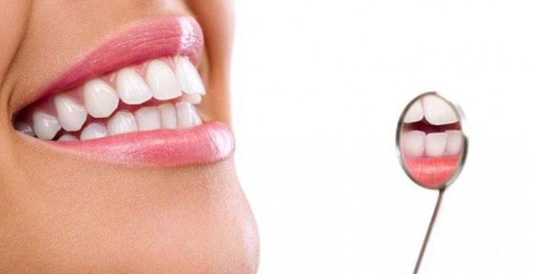 Foto de sorriso com clareamento dental e dentes mais brancos