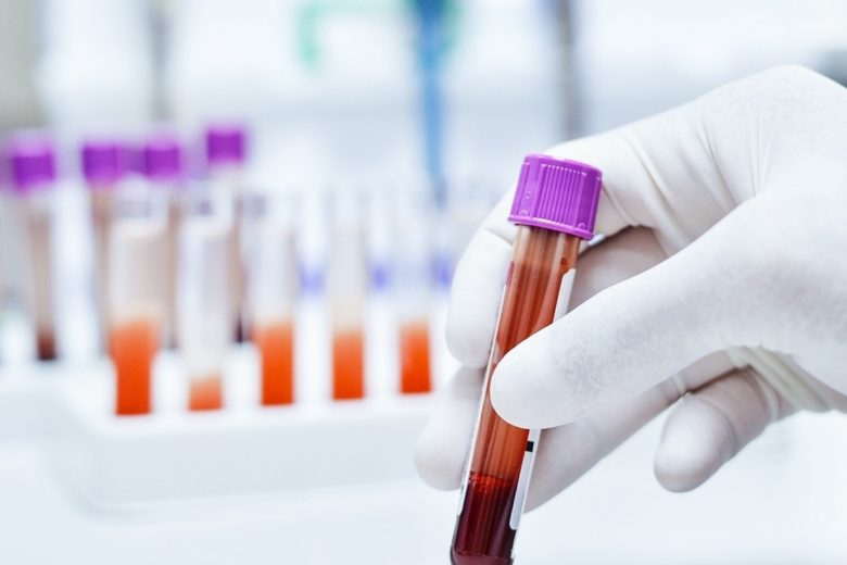 imagem exame de sangue composto s pela clínica sim exames laboratoriais preço popular