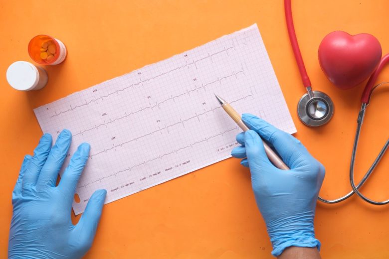 foto de exame ecocardiograma com preço popular na clínica sim. eletrocardiograma popular