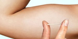 Implanon - Procedimento realizado na Clínica SiM de implante anticoncepcional